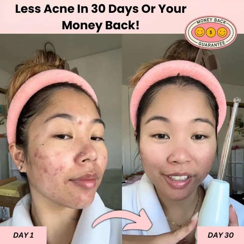 hexibella-001 Varita de Belleza Hexibella