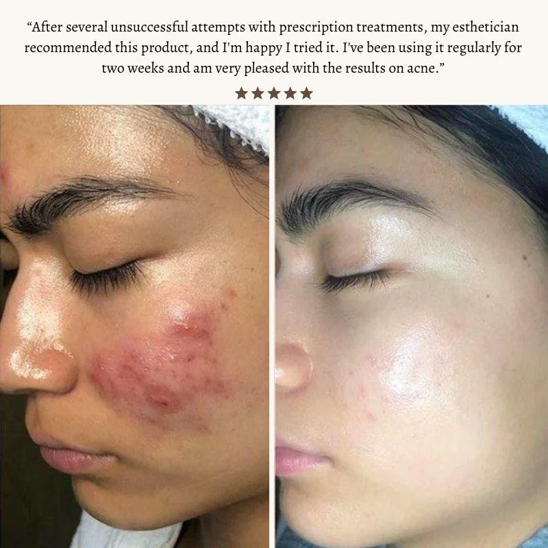 hexibella-006 Varita de Belleza Hexibella