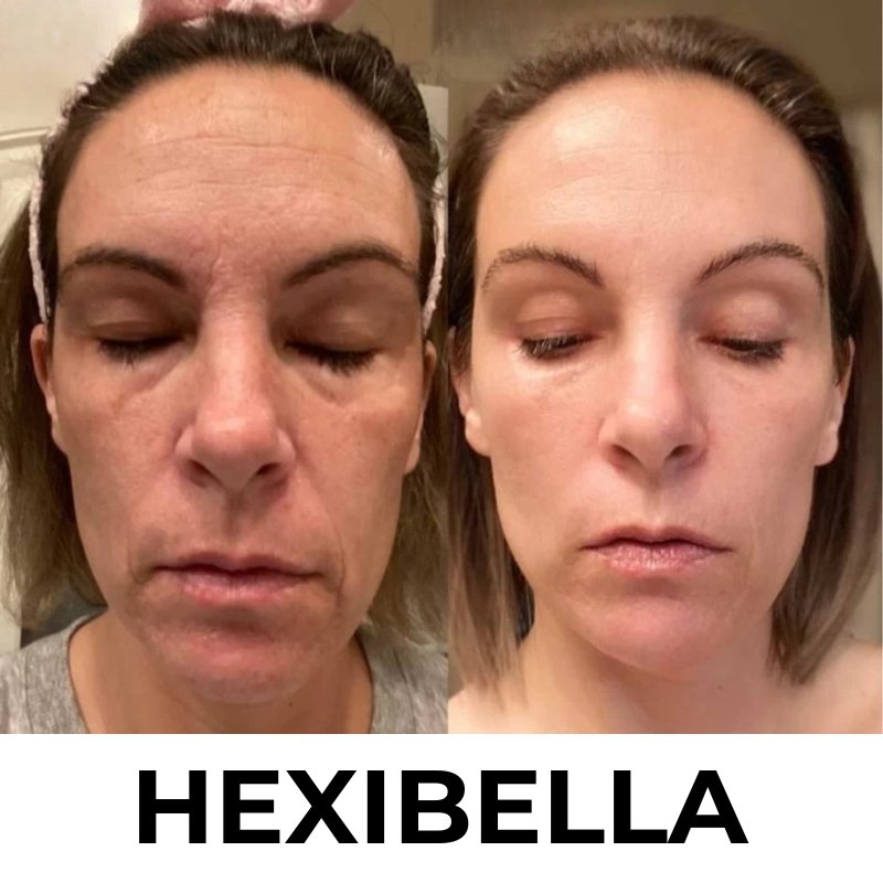 Hexibella MicroGlow Apparaat
