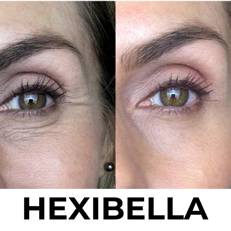 Hexibella MicroGlow Apparaat