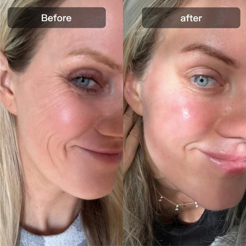 Hexibella MicroGlow Apparaat