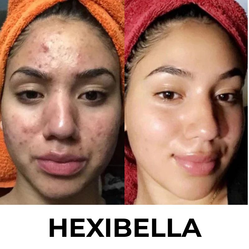 HEXIBELLA (59) Hexibella Beef Tallow + Honey Cream