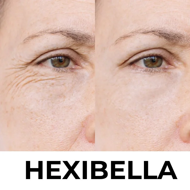 hexibella-001 Hexibella Red Light Device