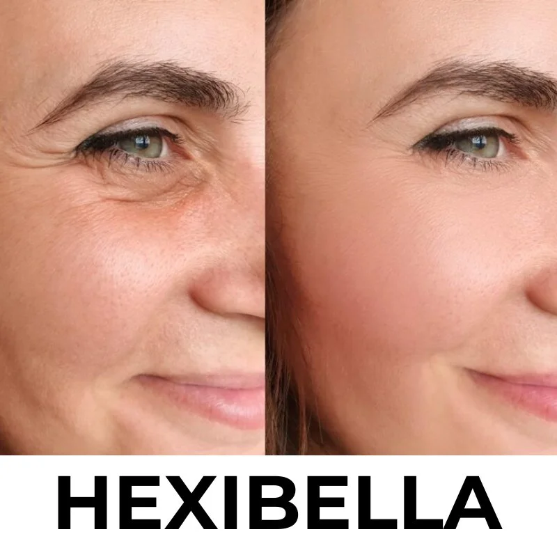 hexibella-002 Hexibella Red Light Device