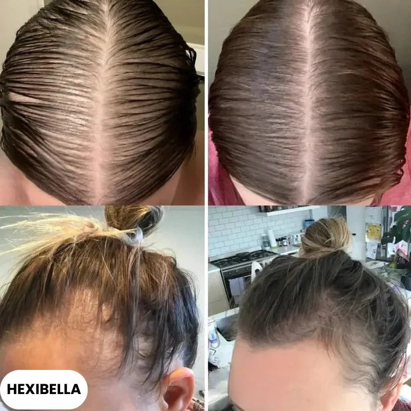 hexibella-002 Hexibella Sérum capillaire 5-en-1