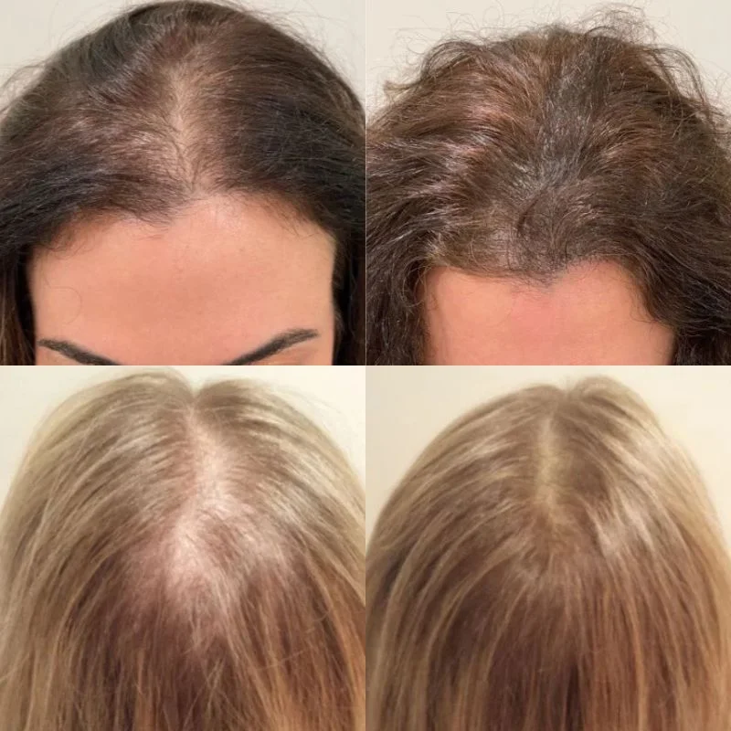 hexibella-003 Hexibella Sérum capillaire 5-en-1