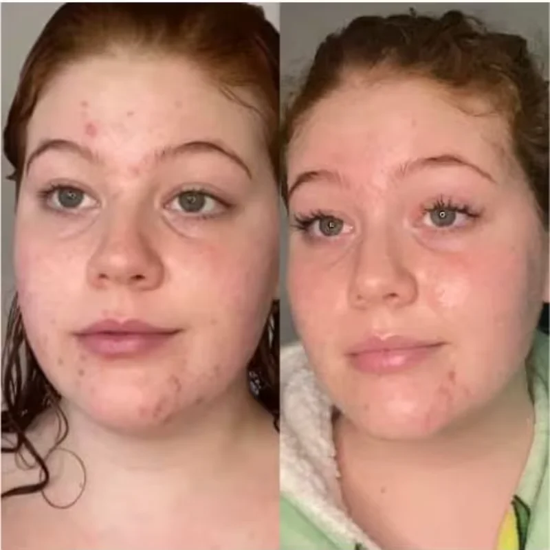 hexibella-013 Fronha de seda Hexibella