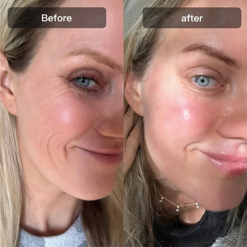 hexibella-014 Hexibella Red Light Device