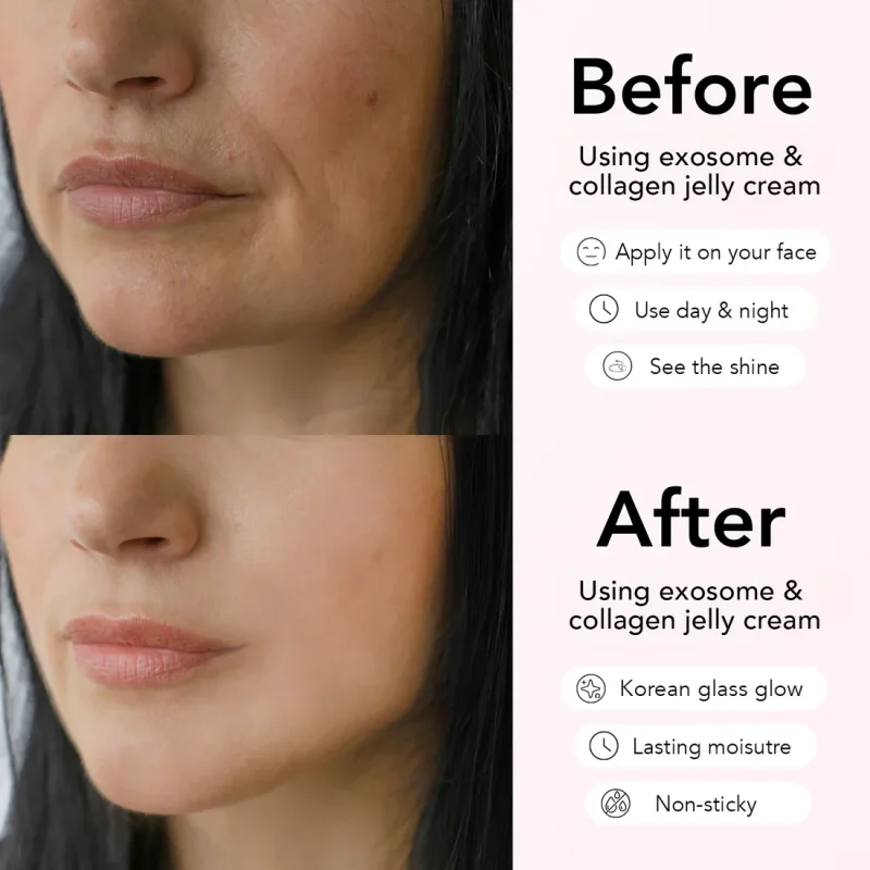 Gelée de collagène et de niacinamide + masque gratuit