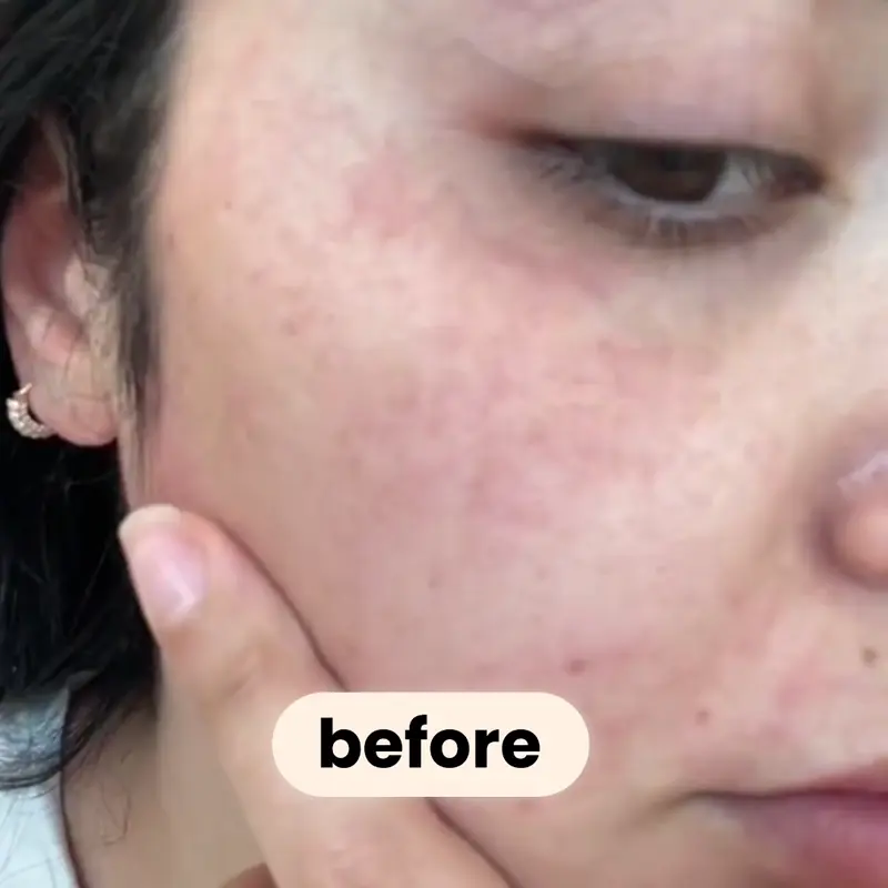 Máscara Coreana de Bio-Colágeno
