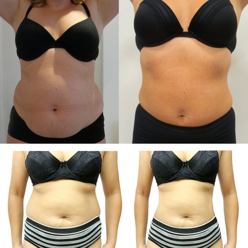 Tónico corporal Hexi