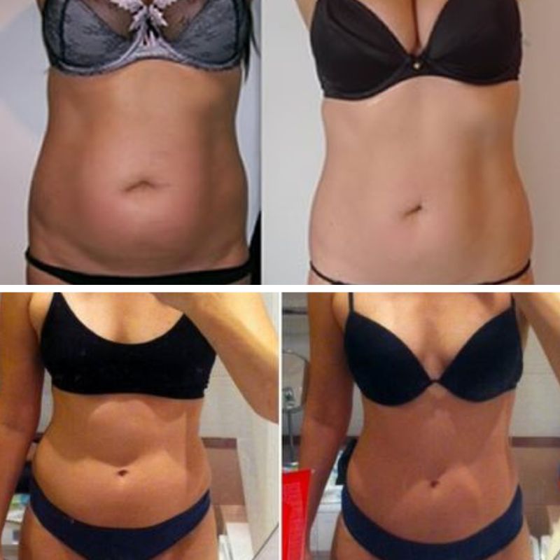 Tónico corporal Hexi