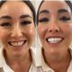 Zestaw NanoSmile