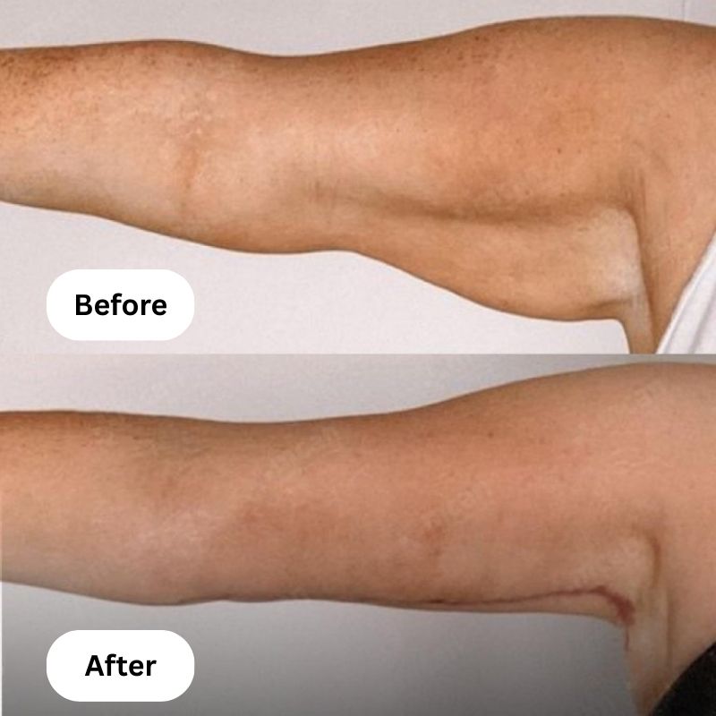 Tónico corporal Hexi