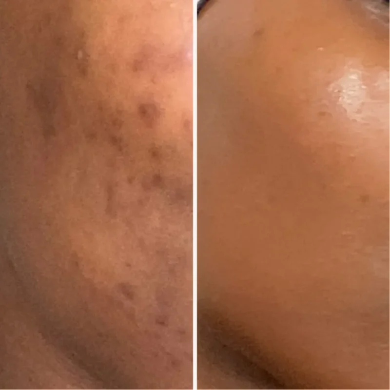 SIDEM - Foaming Powder